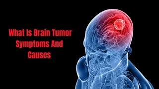 Dushyant Verma Southern Avenue - What Is Brain Tumor Symptoms And Causes  Digital slide making software