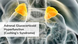 Adrenal Glucocorticoid Hyperfunction (Cushing’s Syndrome),