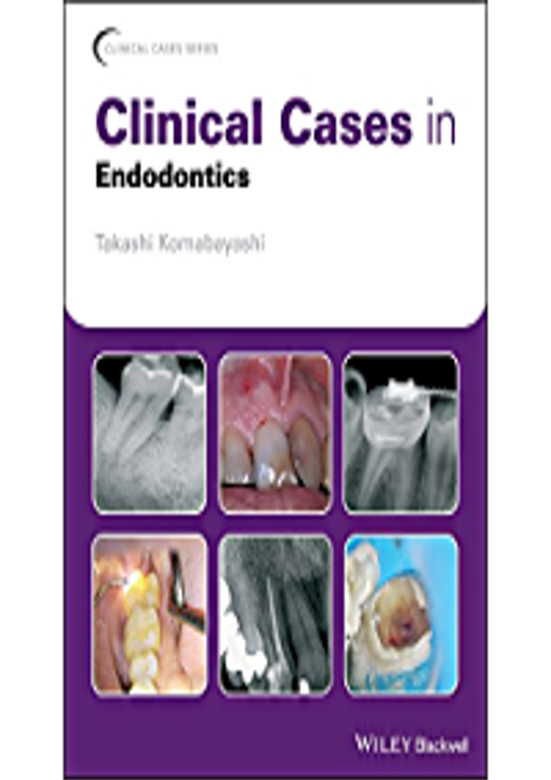[PDF]⚡DOWNLOAD Clinical Cases in Endodontics (Clinical Cases